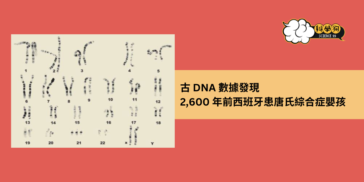 古 DNA 數據發現 2,600 年前西班牙患唐氏綜合症嬰孩 - 科學狗